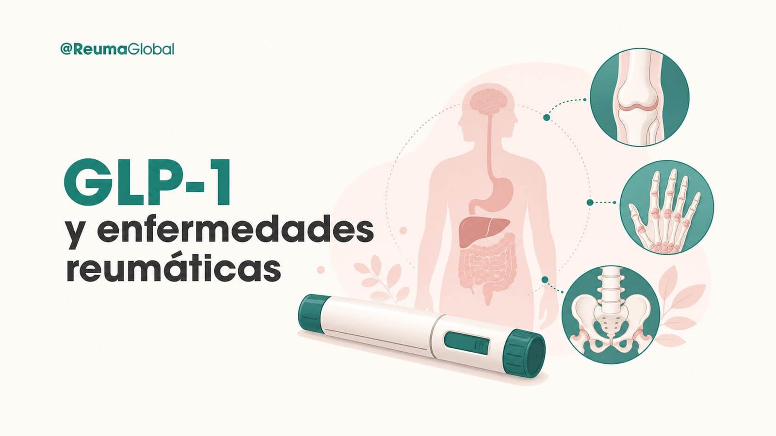 glp1-portada-blog-margen-seguro