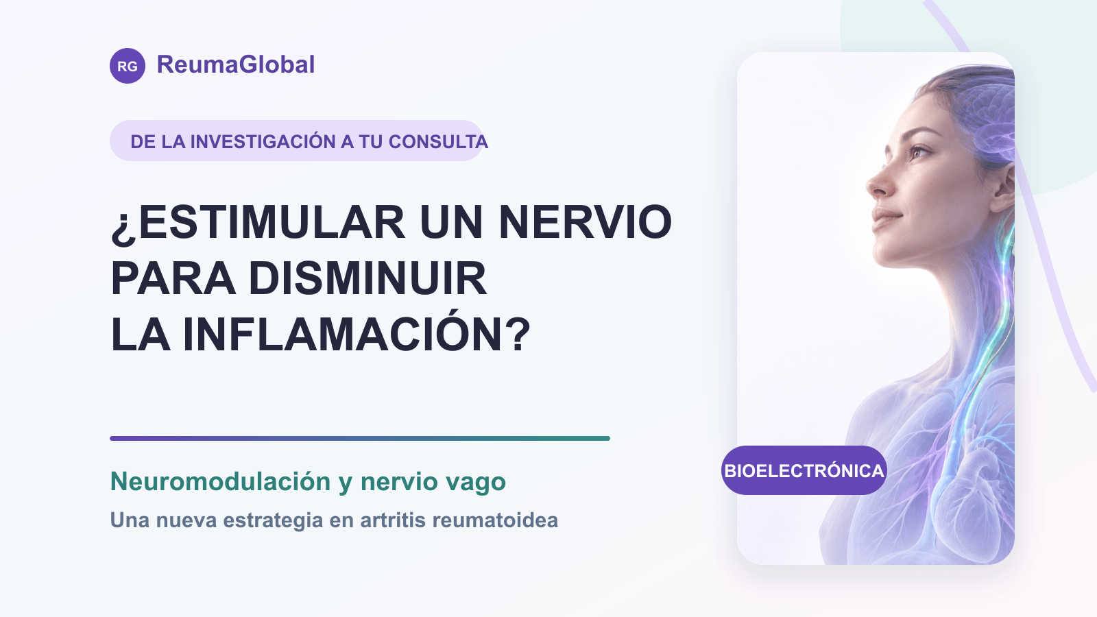 Neuromodulación y nervio vago en artritis reumatoidea Neuromodulación del nervio vago en artritis reumatoidea